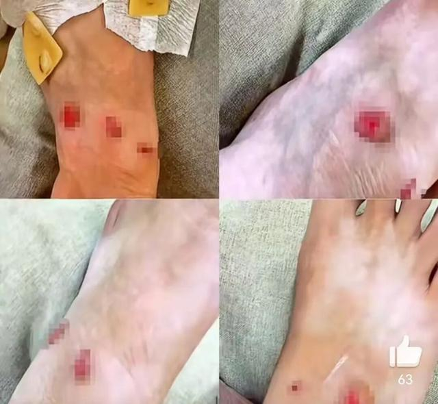 热搜第一!女子购LV鞋穿后多处破皮,要求退货却被拒?品牌回应