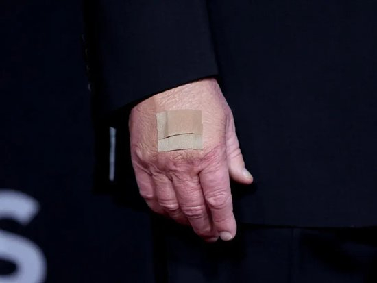 手上淤青真相来了?特朗普强调自己非常健康但后悔一件事