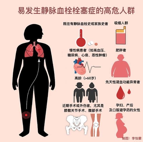 春运长时间乘车乘机，这些防血栓知识请记好