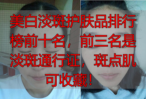 美白淡斑护肤品排行榜前十名,前三名是淡斑通行证,斑点肌可收藏!